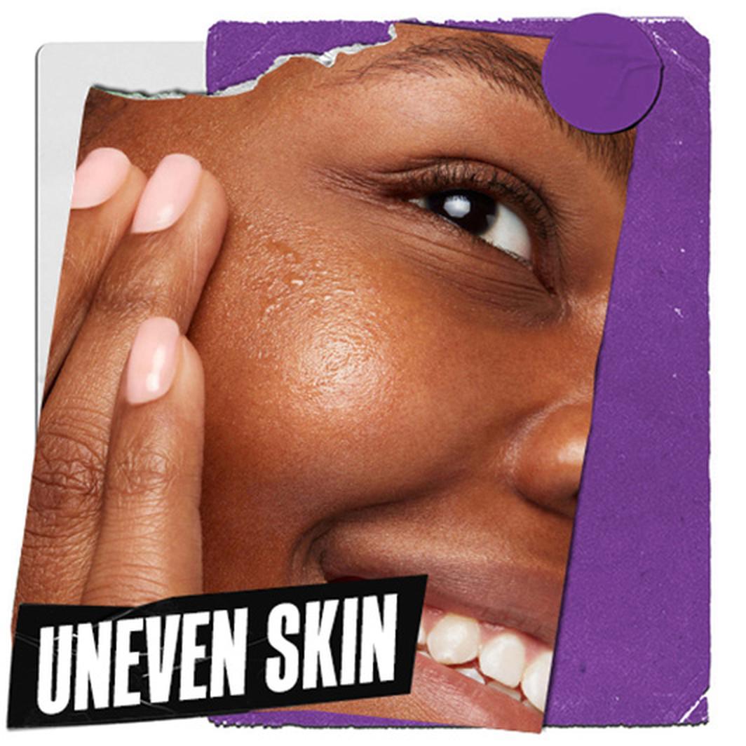 UNEVEN SKIN