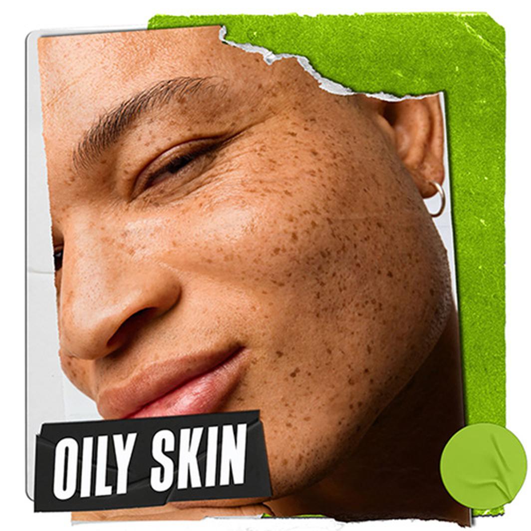 OILY SKIN