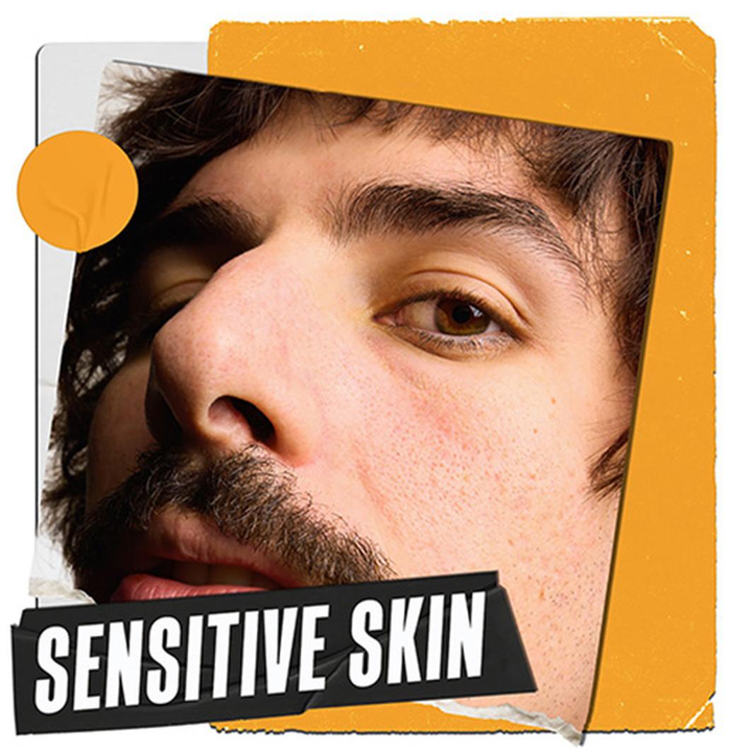 SENSITIVE SKIN