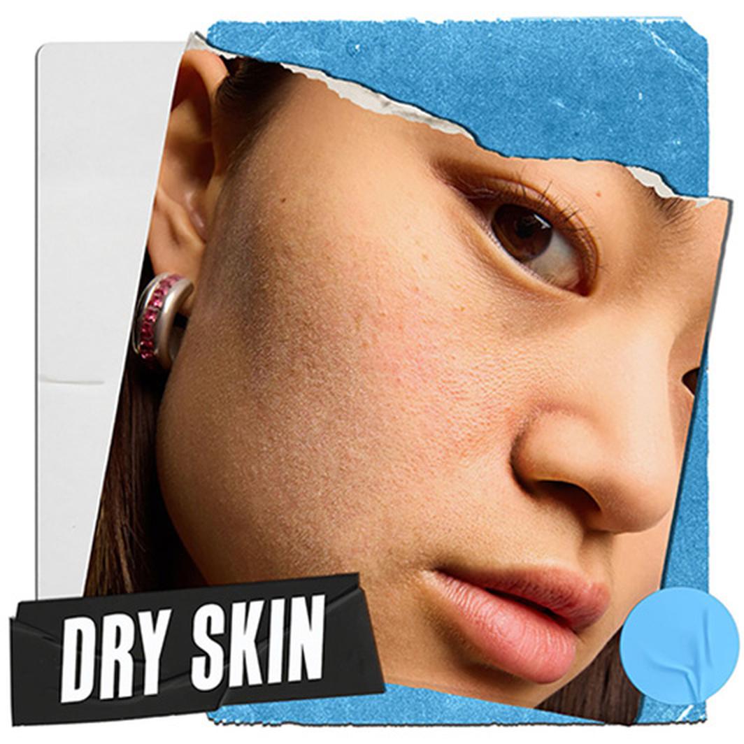 DRY SKIN