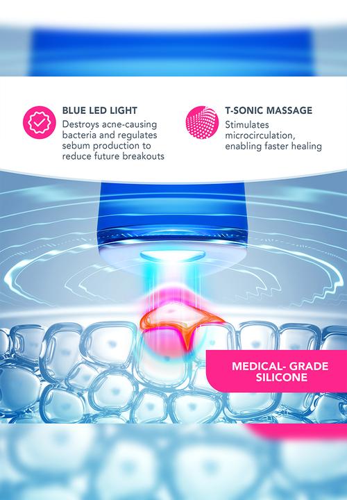 FOREO Sweden - ESPADA™ Acne Treatment - Fuchsia