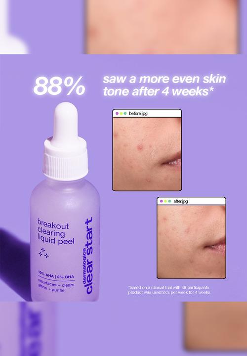 Clear Start by dermalogica - clear start breakout clearing liquid peel