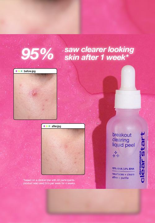 Clear Start by dermalogica - clear start breakout clearing liquid peel