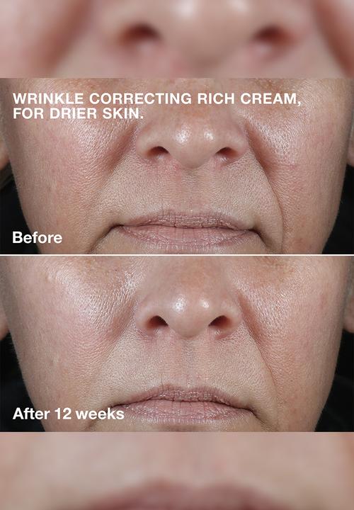 Clinique - Smart Clinical Repair™ Wrinkle Correcting Rich Cream