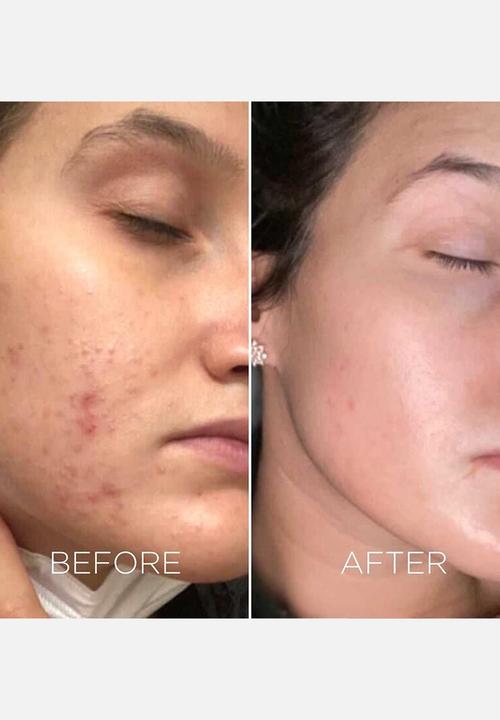 Dr.BRANDT - Dark Spots No More