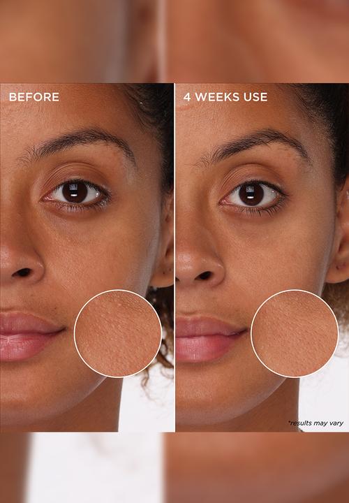 Benefit Cosmetics - The POREfessional Tight 'N Toned Pore-Refining AHA + PHA Toning foam
