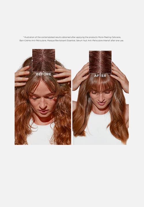 Kerastase  - Symbiose Micro-Peeling Cellulaire - Scalp & Dandruff Treatment