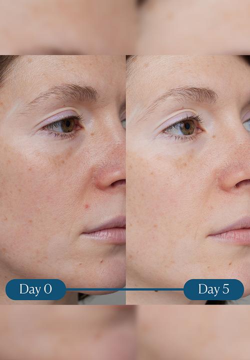 ELEMIS - Dynamic Resurfacing Super - C Serum