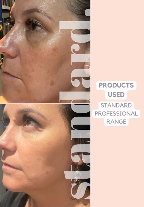 Standard Beauty - Vitamin ABCDEF Masque For Dull & Lacklustre Skin