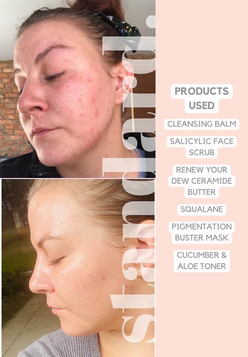 Standard Beauty - Squalane Serum