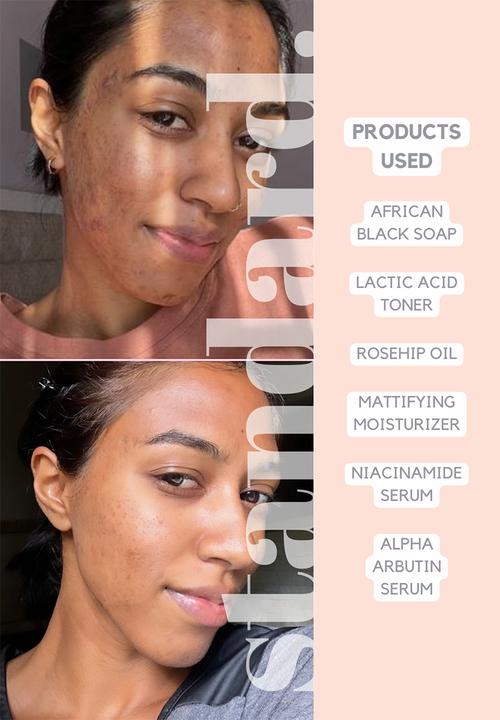 Standard Beauty - Alpha Arbutin 1,5% Serum
