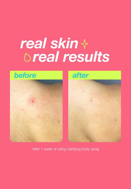 Clear Start by dermalogica - Clarifying Body Spray