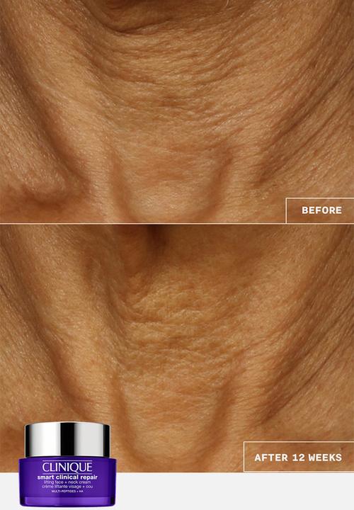 Clinique - Smart Clinical Repair Lifting Face + Neck Cream