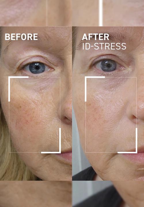 Dr.BRANDT - Icy Gel Moisturizer