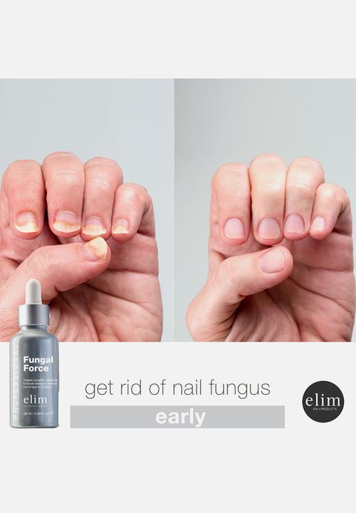 Elim - Fungal Force
