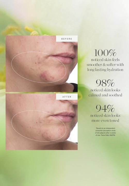KORA Organics - Active Algae Lightweight Moisturizer Mini