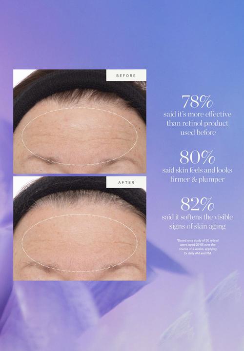 KORA Organics - Plant Stem Cell Retinol Alternative Serum