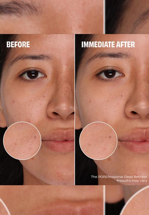 Benefit Cosmetics - All You Knead Is Pore Set