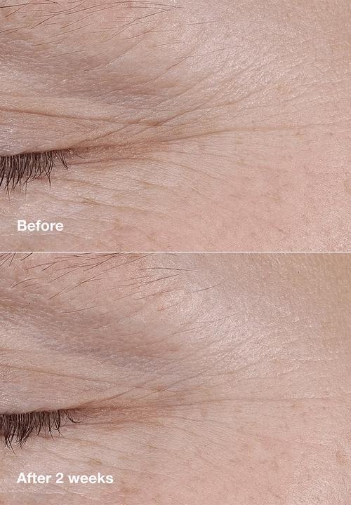 Clinique - Smart Clinical Repair AM/PM Retinoid Balm