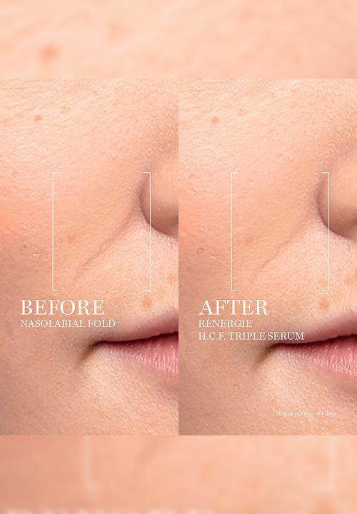 Lancôme - Rénergie H.C.F. Triple Serum