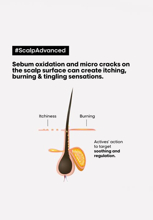 L’Oreal Professionnel - Scalp Advanced Intense Soother Treatment for Sensitive, Itchy Scalps -