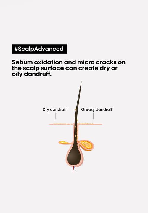 L’Oreal Professionnel - Scalp Care Anti-Dandruff Lightweight Shampoo - 300ml