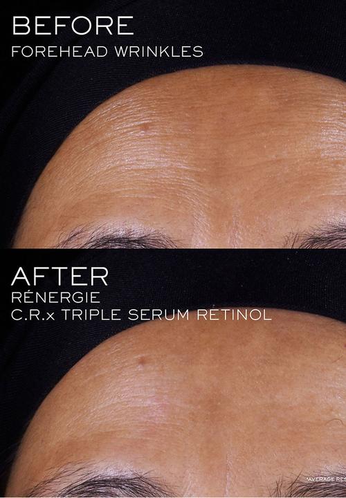 Lancôme - Lancôme Rénergie C.R.X. Triple Serum Retinol 50ml