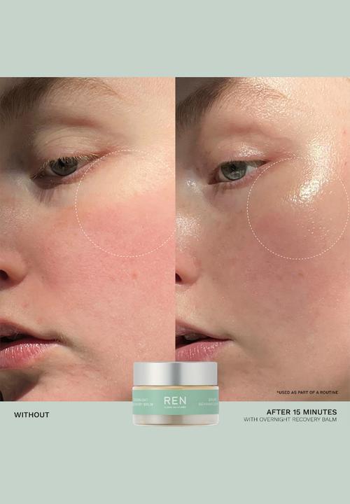 REN Clean Skincare - Evercalm™ Sensitive Skin Heroes Starter Kit