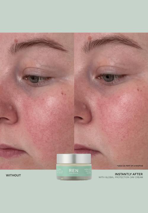 REN Clean Skincare - Evercalm™ Sensitive Skin Heroes Starter Kit
