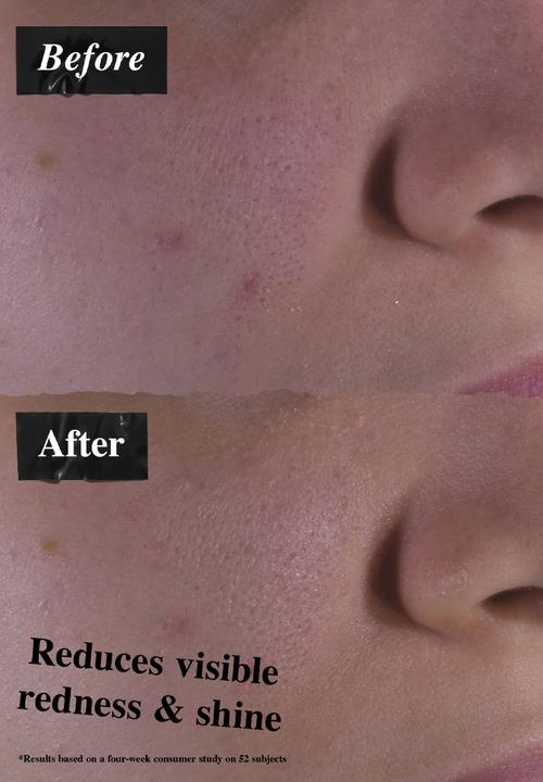 Kiehl's - Calendula Herbal Extract Alcohol-Free Toner