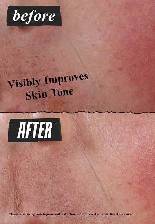 Kiehl's - Ultra Facial Advanced Repair Barrier Cream