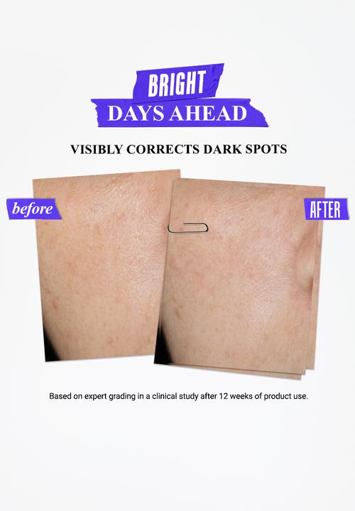 Kiehl's - Clearly Corrective™ Dark Spot Solution