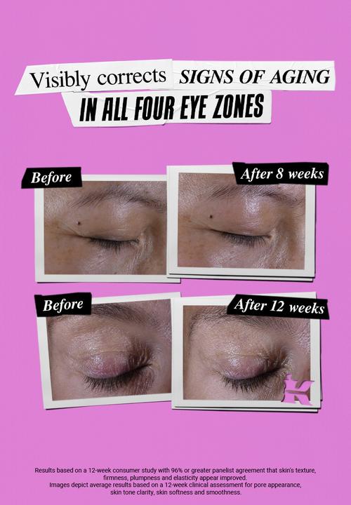 Kiehl's - Super Multi Eye Zone Treatment - 28ml