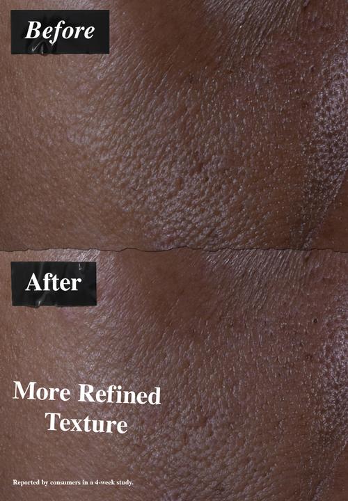 Kiehl's - Ultra Pure High-Potency 9.8% Glycolic Acid Serum