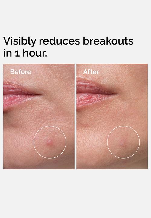The Ordinary. - Sulfur 10% Powder-to-Cream Concentrate 5g