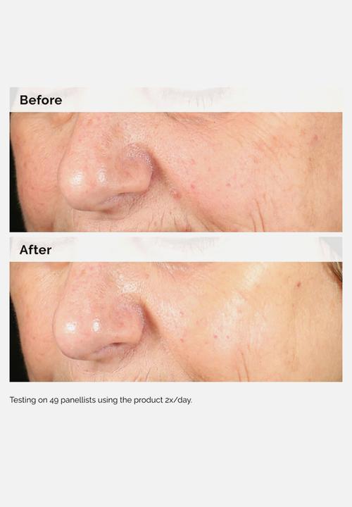 The Ordinary. - Alpha Arbutin 2% + HA 30ml