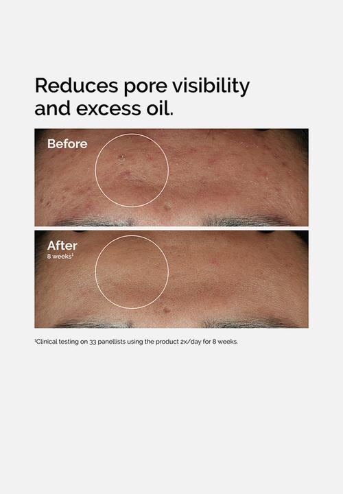 The Ordinary. - Niacinamide 10% + Zinc 1% - 30ml