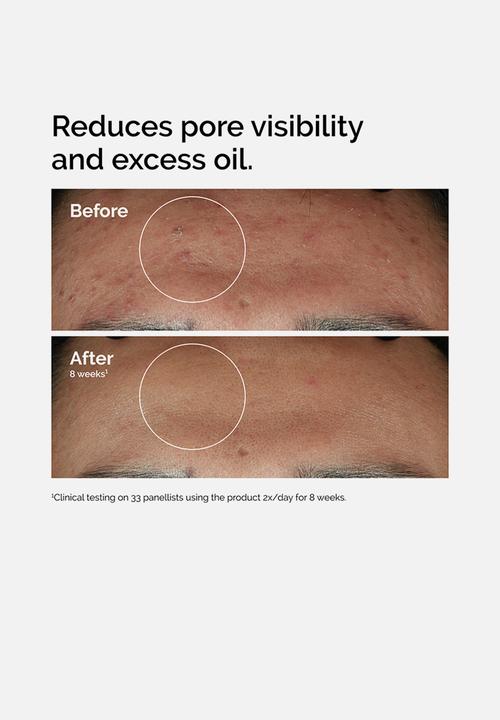 The Ordinary. - Niacinamide 10% + Zinc 1% - 60ml