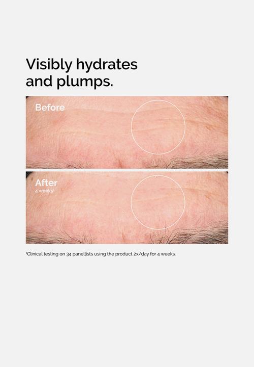 The Ordinary. - Hyaluronic Acid 2% + B5 - 30ml
