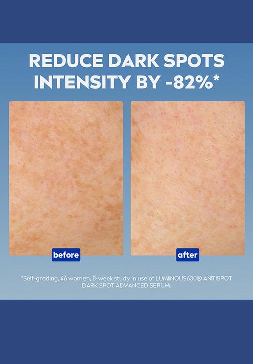 Nivea - Perfect and Radiant LUMINOUS630 Anti Dark Marks Treatment Serum - 30ml