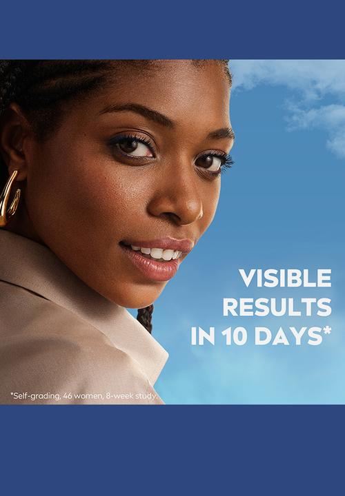 Nivea - Perfect and Radiant Luminous 630 Anti Dark /Age/Spot Marks Serum - 30ml