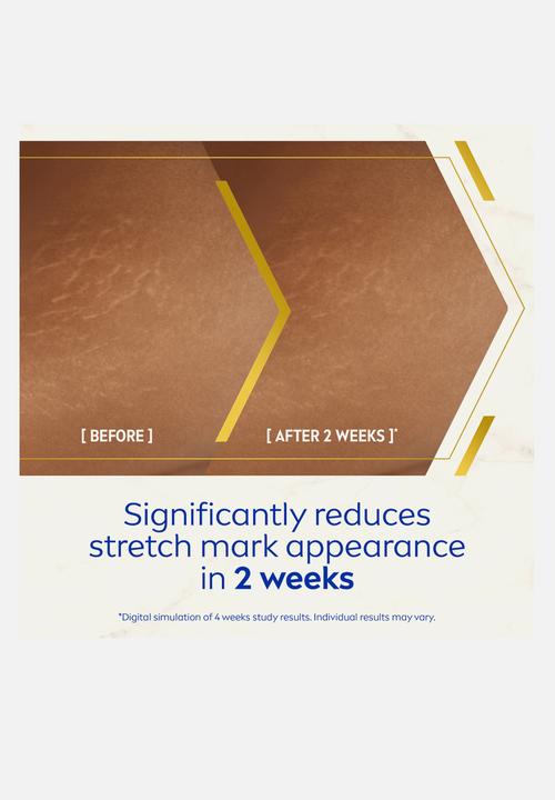 Nivea - LUMINOUS630 Anti Stretch Marks Body Oil-Serum - 100ml