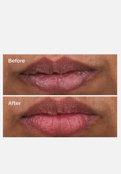 The Ordinary. - PHA 5% Exfoliating Lip Serum