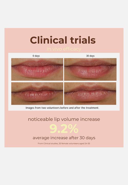 Standard Beauty - Peptide Lip Glaze with Hyaluronic Acid