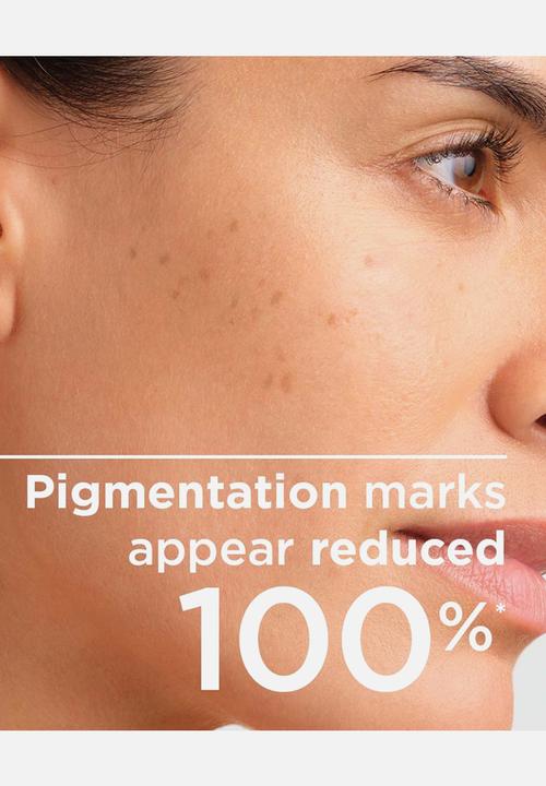 BIODERMA - Pigmentbio Foaming Cream