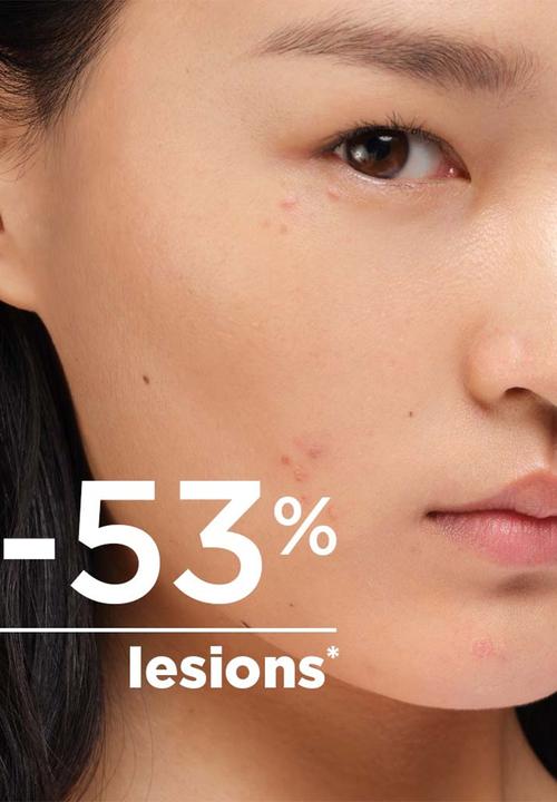 BIODERMA - Sébium Kerato+ Anti-Acne Cream