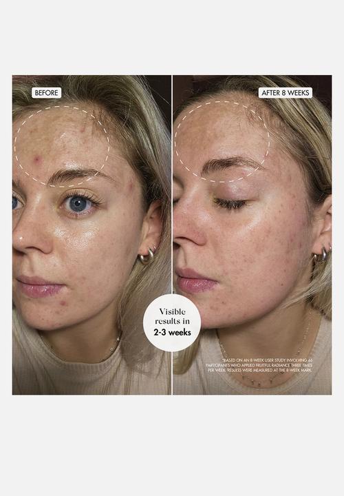 SKOON. - Fruitful Radiance - Renewal Night Liquid Exfoliant