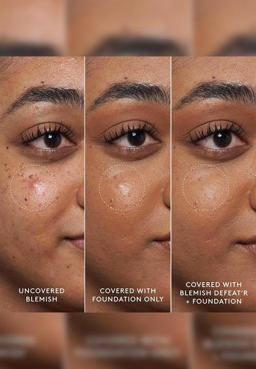 Fenty Beauty - Fenty Blemish Defeat?r BHA Spot-Targeting Gel