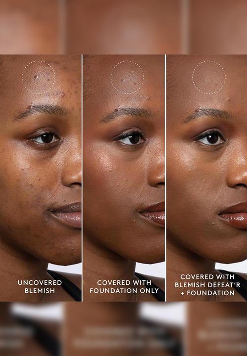 Fenty Beauty - Fenty Blemish Defeat?r BHA Spot-Targeting Gel