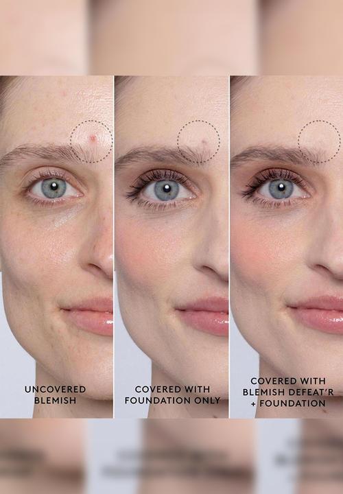 Fenty Beauty - Fenty Blemish Defeat?r BHA Spot-Targeting Gel